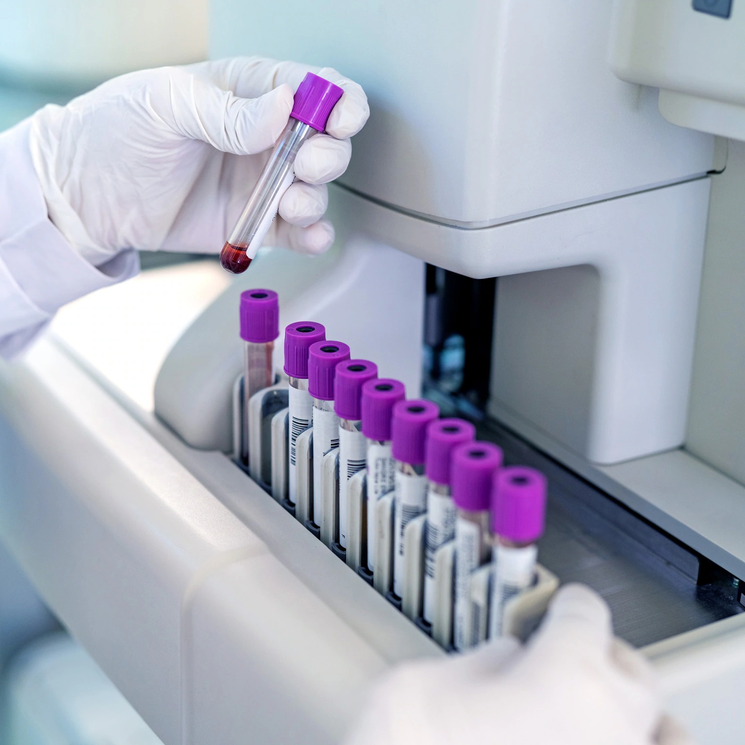 Diagnostic Tests
